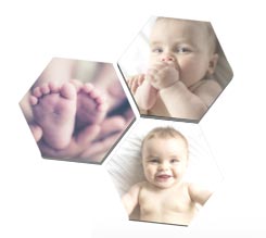 Crea Alveolo in kapafix