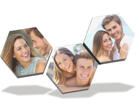 Alveoli in kapafix tre pannelli